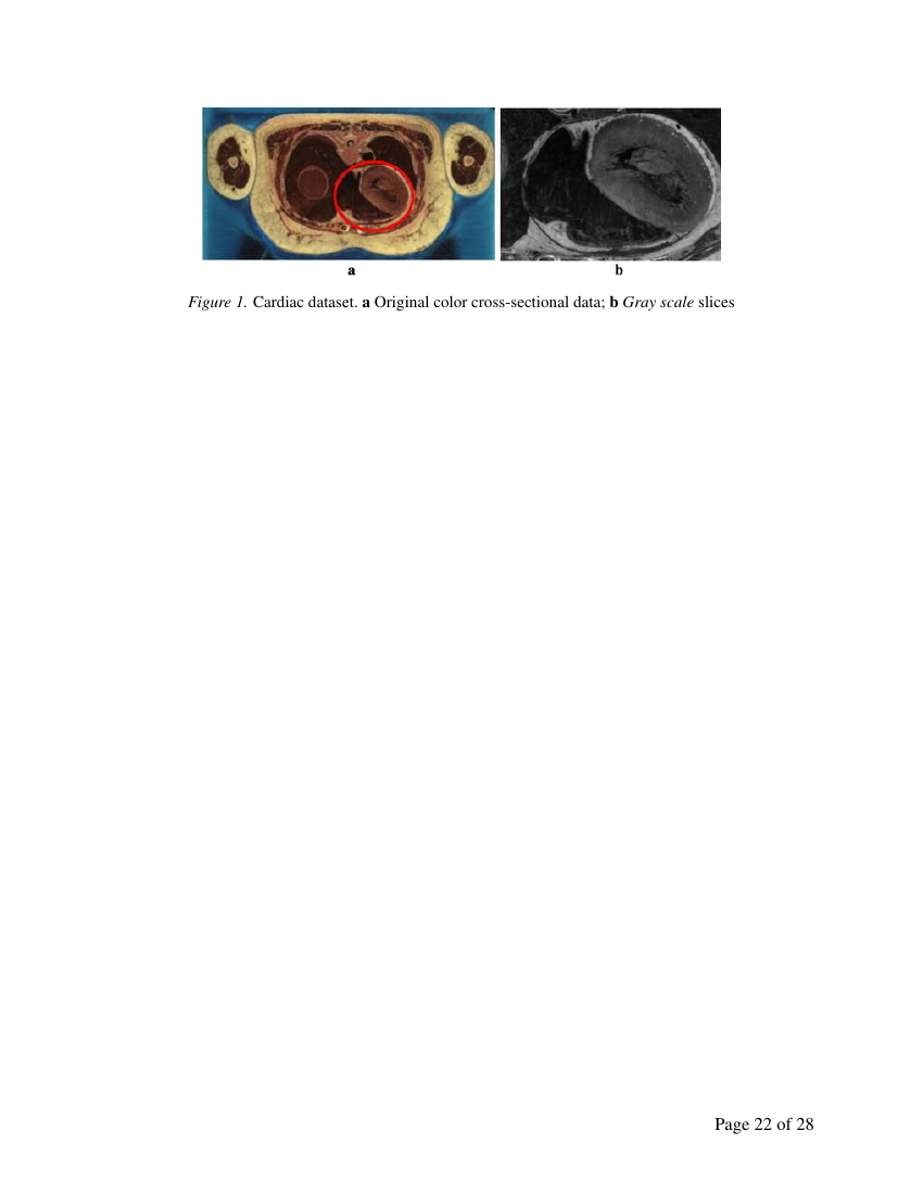 Example of Advances in Obesity Treatment format