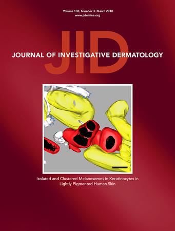 Journal of Investigative Dermatology
